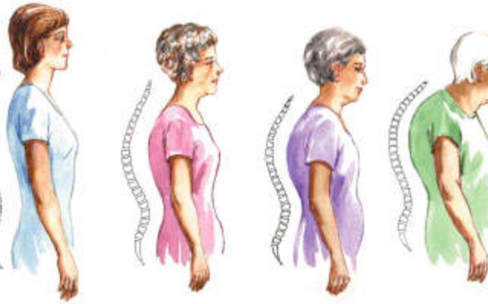 Andrea s Fitness & Art: Old Lady Posture - Part I: How it happens