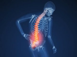 Low-Back-Pain